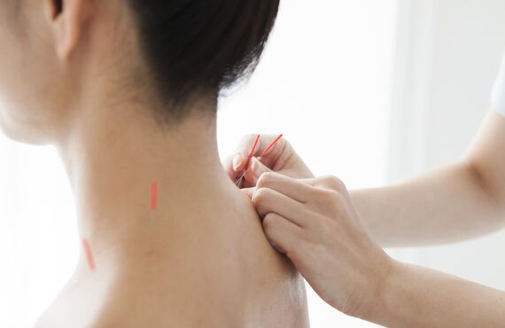 動かしにくい頑固な首コリの根本を鍼の施術で刺激 | 宝塚の鍼灸なら健やかな巡りをもたらす巡り鍼灸院